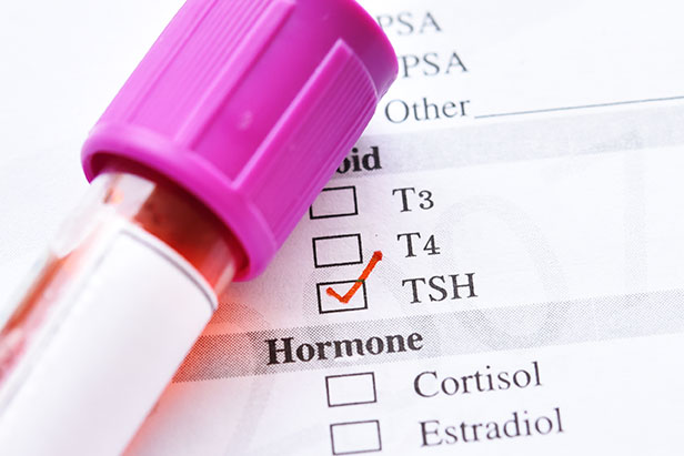Lise Bøgsted, stofskifte blodprøver, TSH, T3 og T4, stofskifte test, skjoldbruskkirtel, lavt stofskifte, hormonbalance
