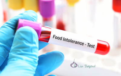 Fødevareintolerancetest – IgG
